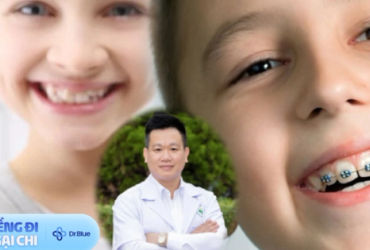 BS khoa Răng Hàm Mặt giải thích lý do trẻ em cần niềng răng và tại sao cần niềng răng sớm