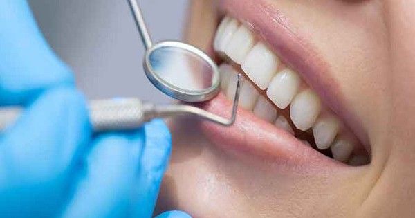 10 điều cần biết về dán sứ veneer