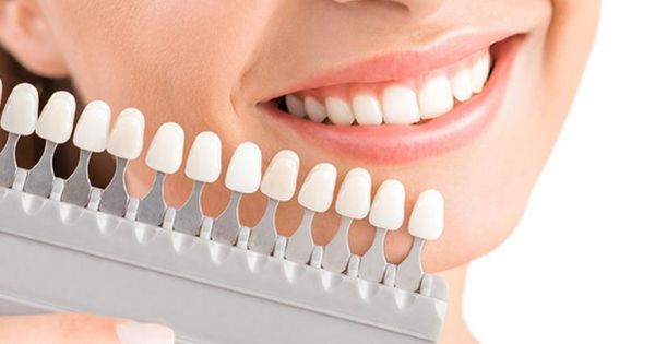 Bí quyết lựa chọn răng sứ giá rẻ vượt trội: Hãy tránh khỏi hiểm họa không ngờ!