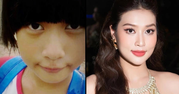 Hoa hậu Thiên Ân nghi vấn dao kéo: Những điểm chỉnh sửa đáng chú ý trên gương mặt