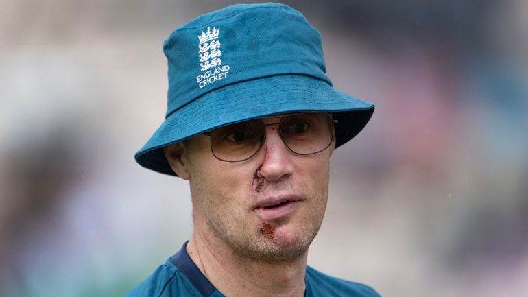 First Exclusive Interview: Andrew Flintoff Breaks Silence on Terrifying Top Gear Crash