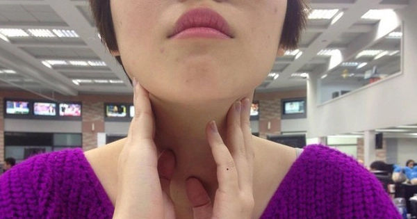 Cô gái 21 tuổi phát hiện ung thư thông qua dấu hiệu ít được chú ý trên cổ