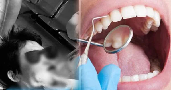 Lần đầu khám răng bị chảy máu nhiều, nguyên nhân gây ra không ngờ đến