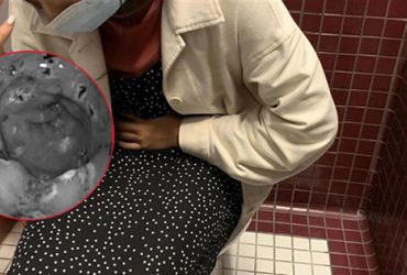 Phát hiện bất thường mắc phải khi nội soi dạ dày: Gần 30 vết loét khiến ngạc nhiên