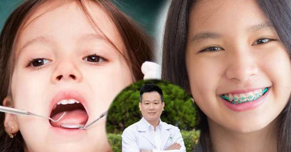 Thời điểm lý tưởng để bắt đầu điều trị răng cho trẻ