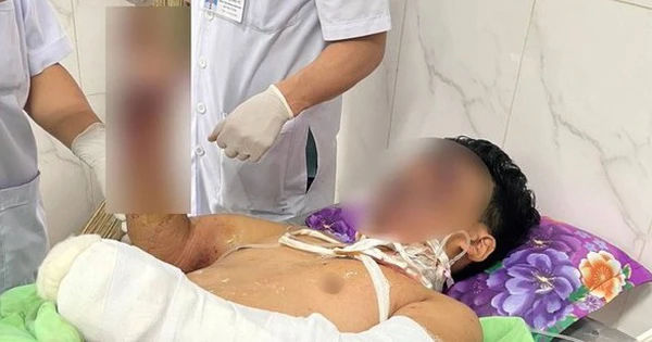 Thương tật, tàn phế, mất mát do sự chơi pháo