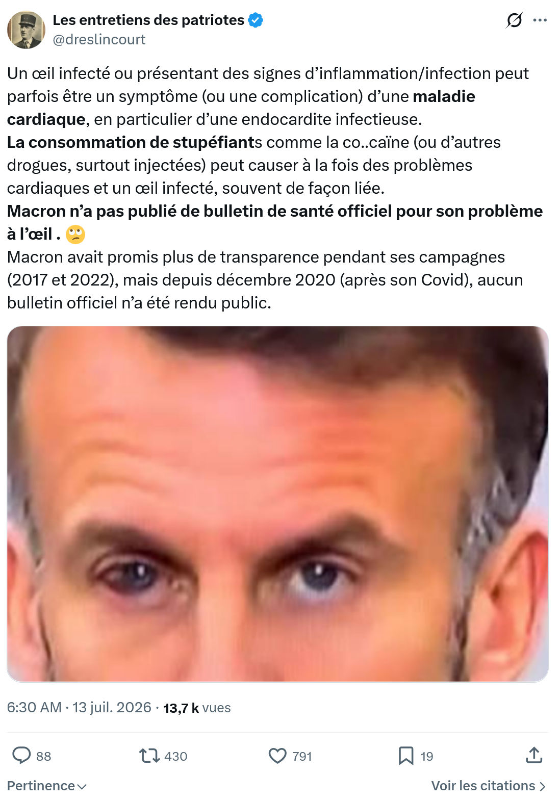 Marquis de Dreslincourt: Un œil infecté ou présentant...