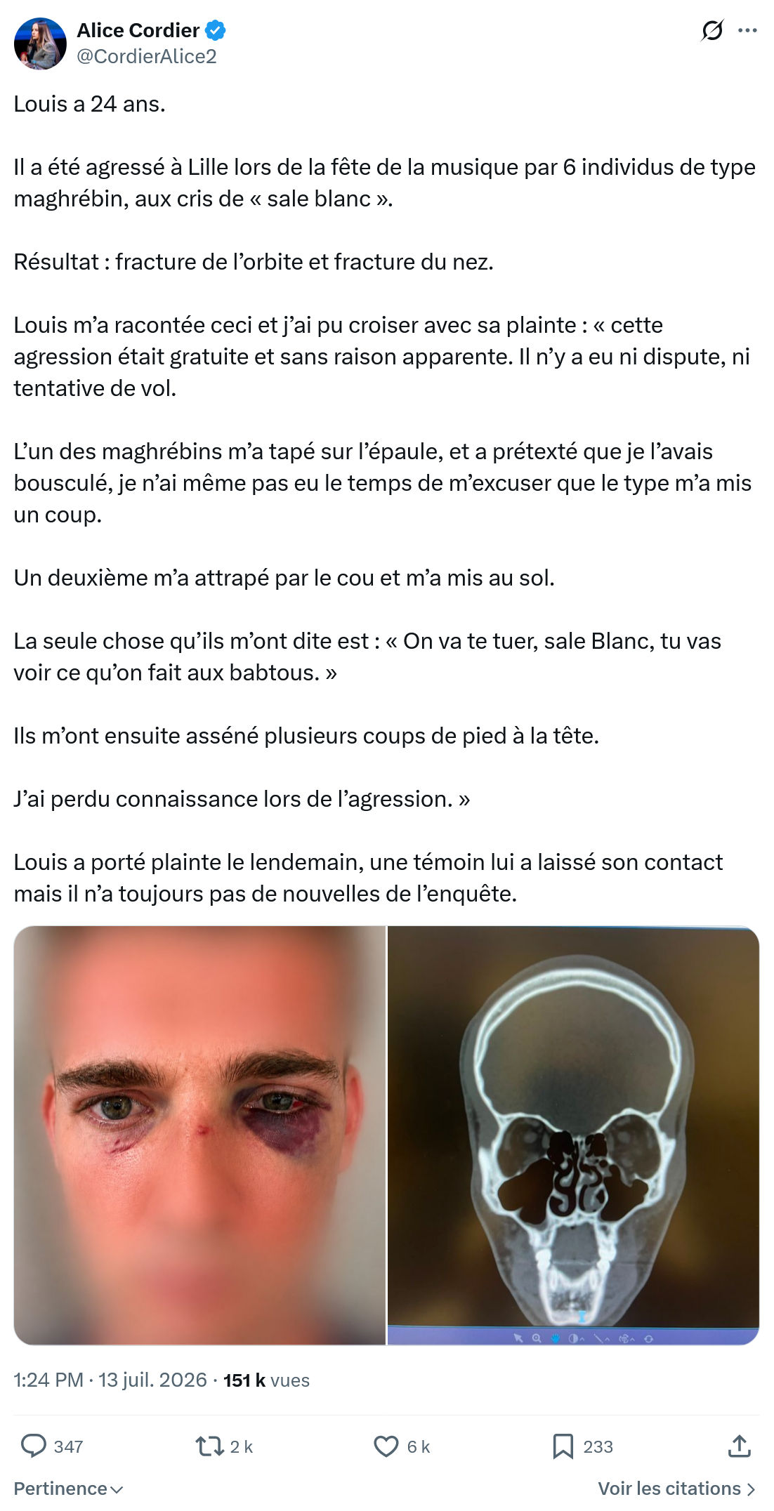 Alice Cordier: Louis a 24 ans...