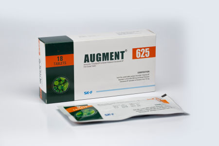 Augment
