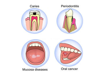 Smile Bright: Essential Tips for Healthy Teeth and Gums You Can’t Ignore