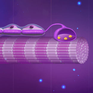 Активация спраутинга после инсульта