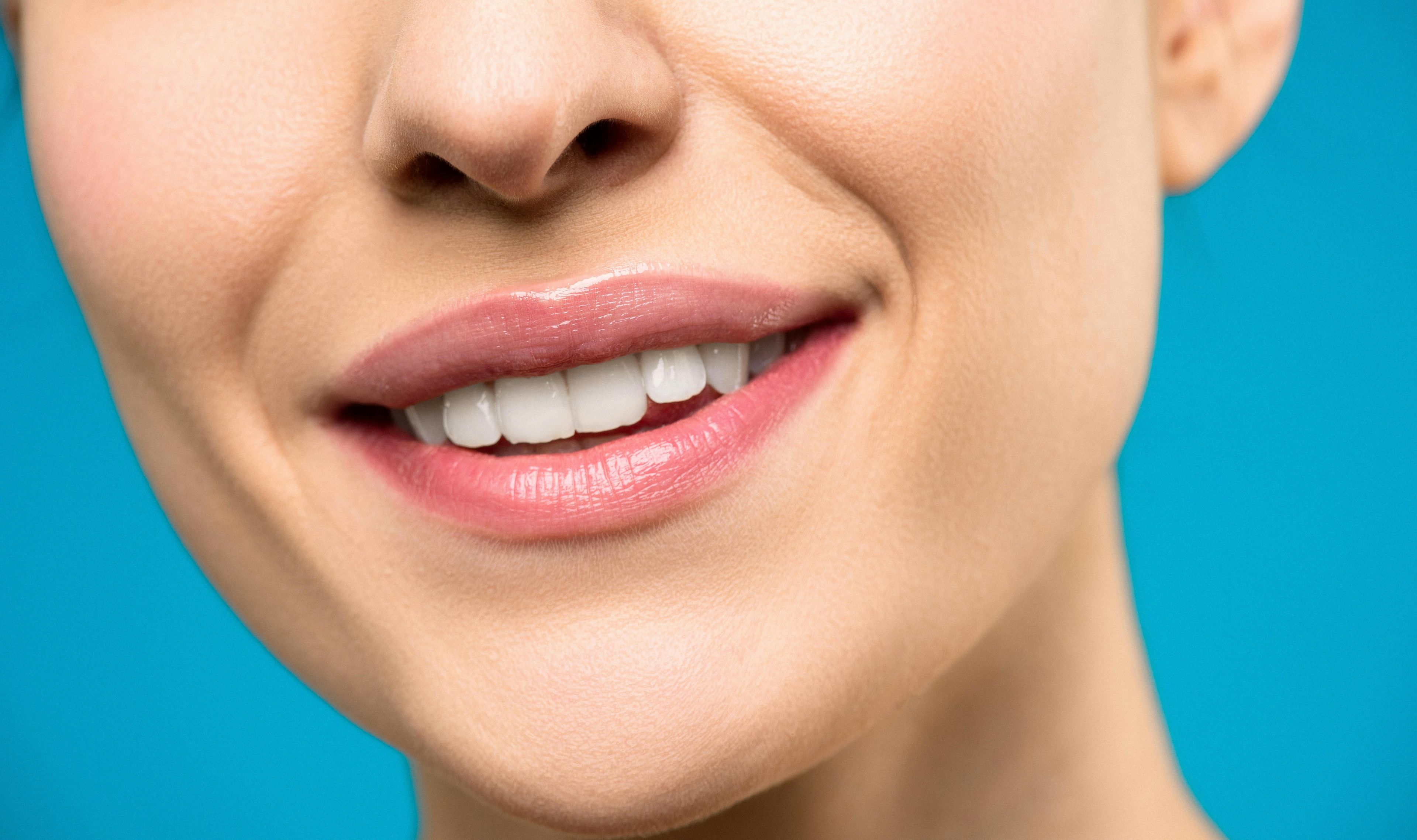 Radiant, fully-restored smile post veneers treatment