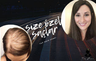 Kadın Protez Saç- Fiyatları Tap Hair Protez Saç Merkezi