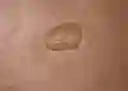 listing-thumbnails