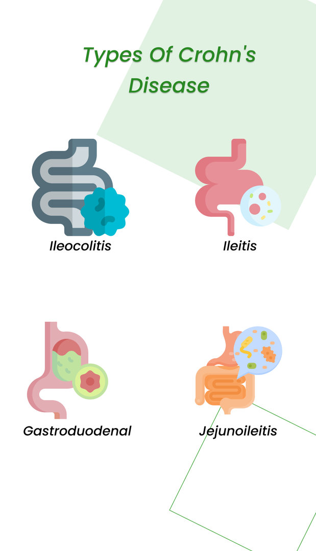 Types of Crohn's disease