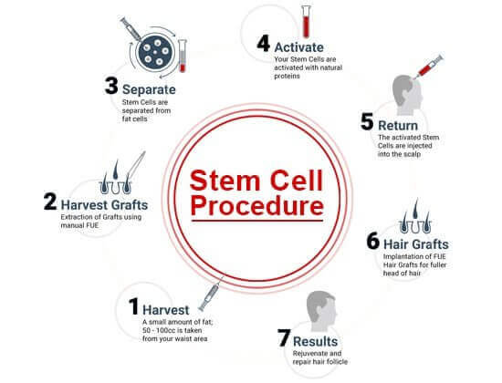 Stem cell FUE