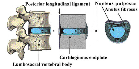 Kyphoplasty