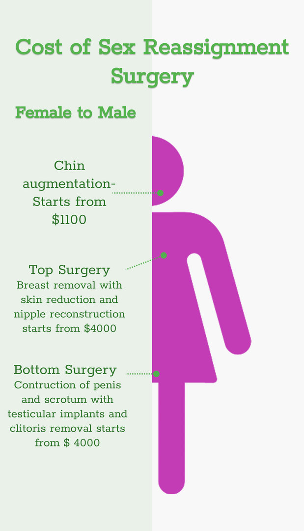 Female-to-male top surgery