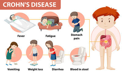 Crohn's symptoms