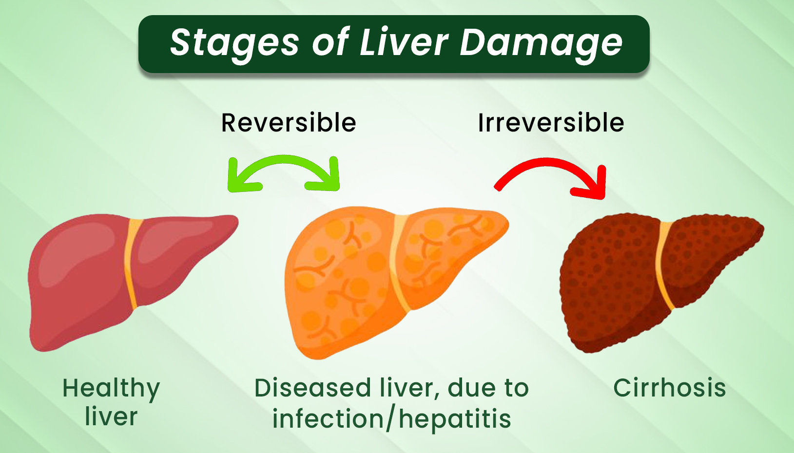 stages of liver damage