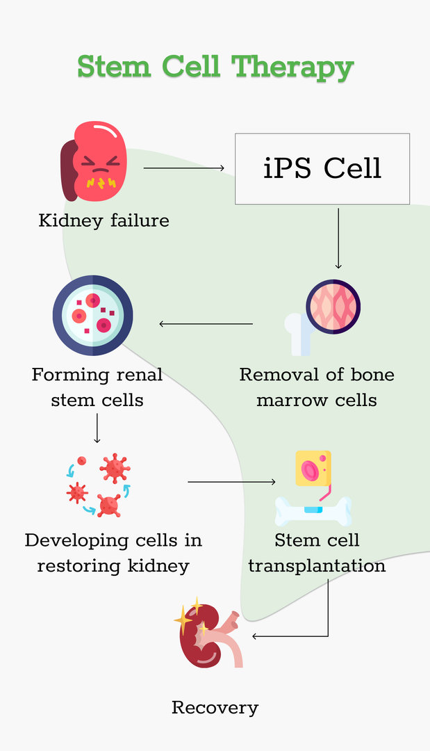 Stem Cell Therapy