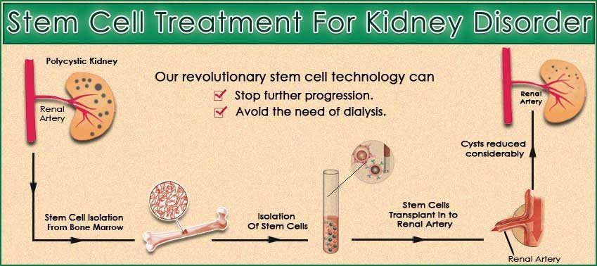 Kidney Failure