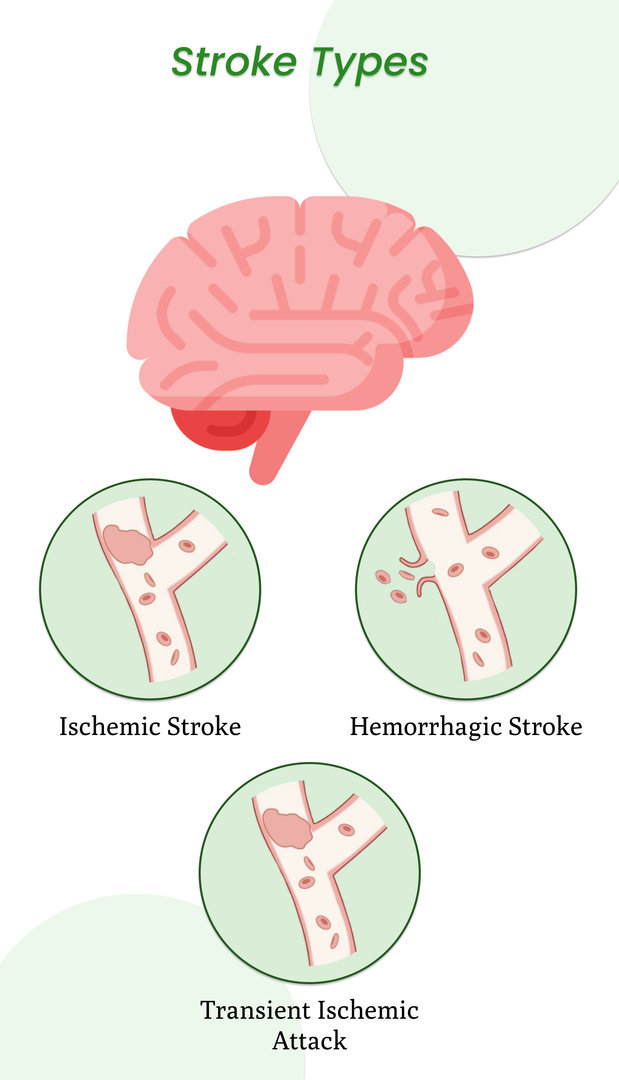 Stroke Types