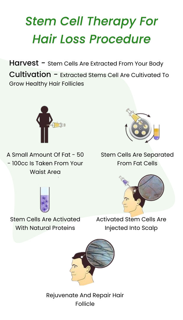 Stem Cell Hair Treatment 2023( All About Stem Cell Therapy for Hair Loss)