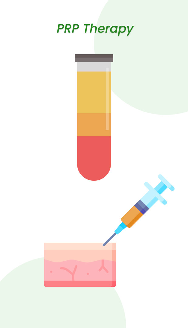 علاج PRP