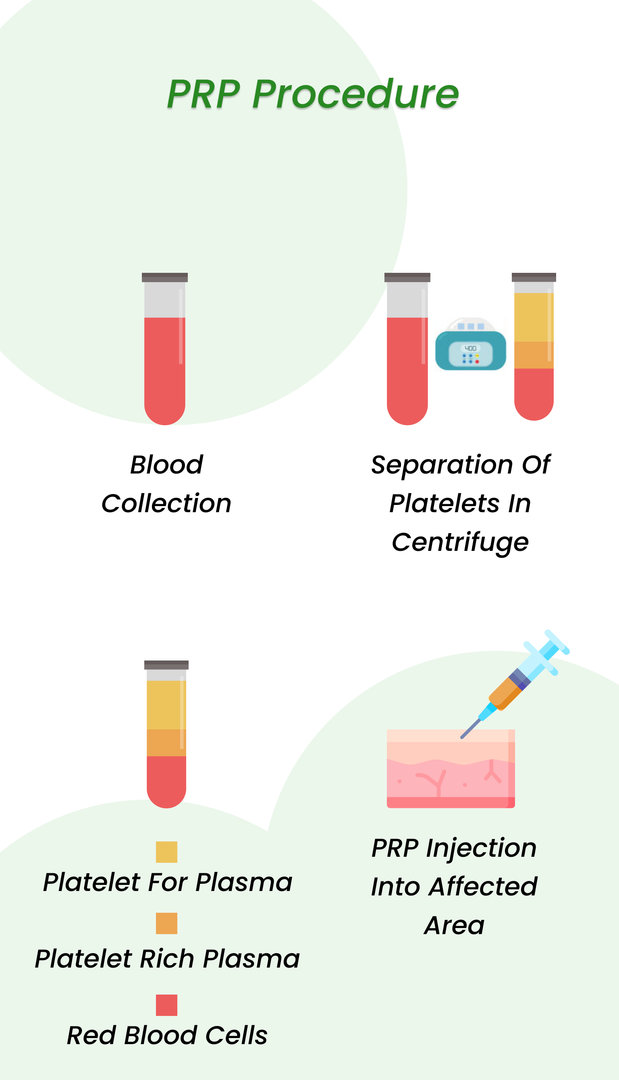 PRP Procedure