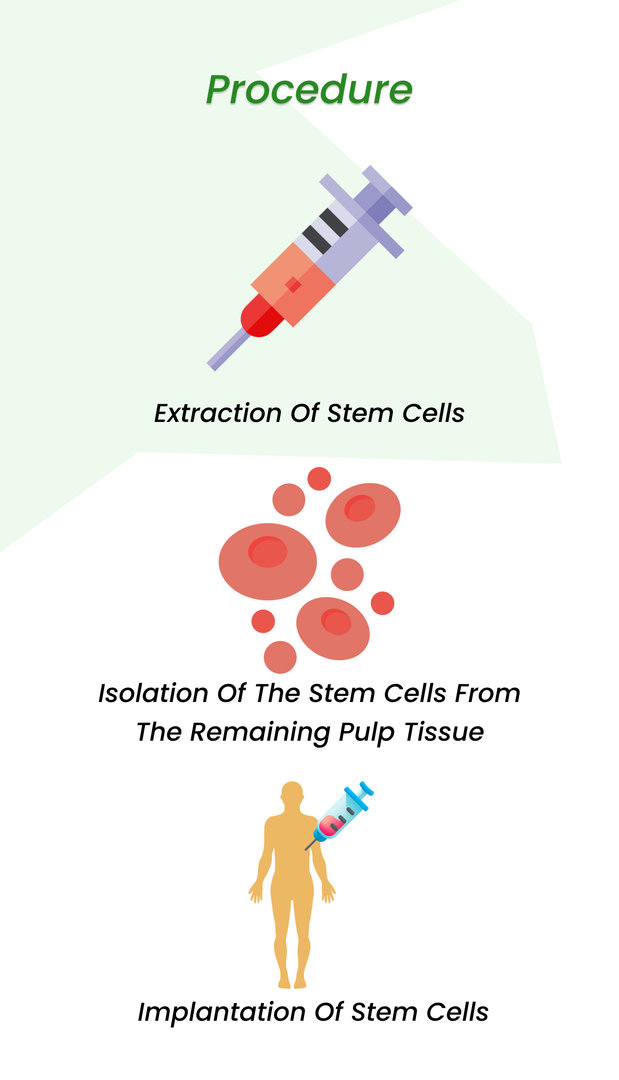 Procedure of Stem Cell Dental Implants