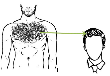 Body hair transplant in Mumbai