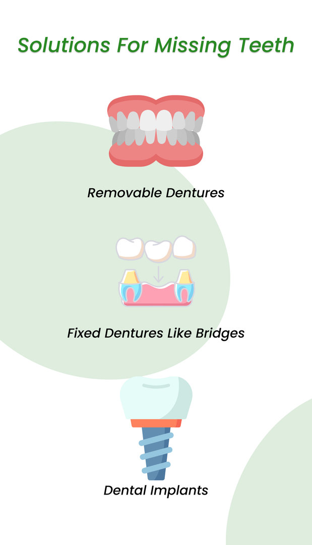 Solutions For Missing Teeth