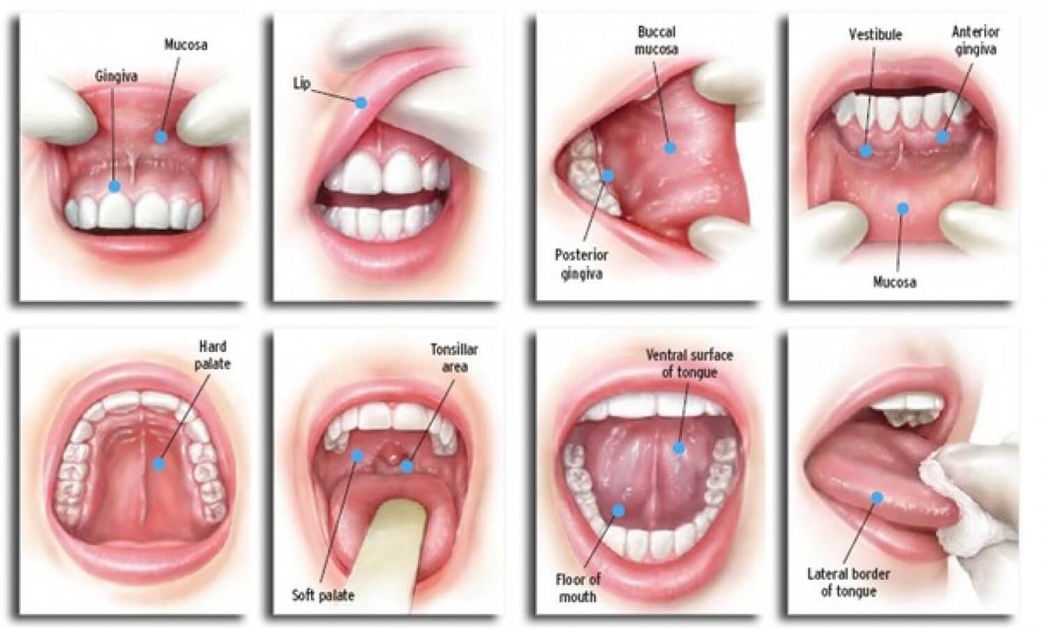 Oral-cancer