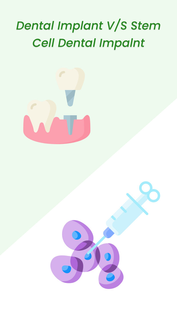 Stem Cell Dental Implants vs Dental Implants