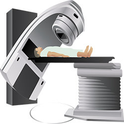 External Beam Radiation Therapy