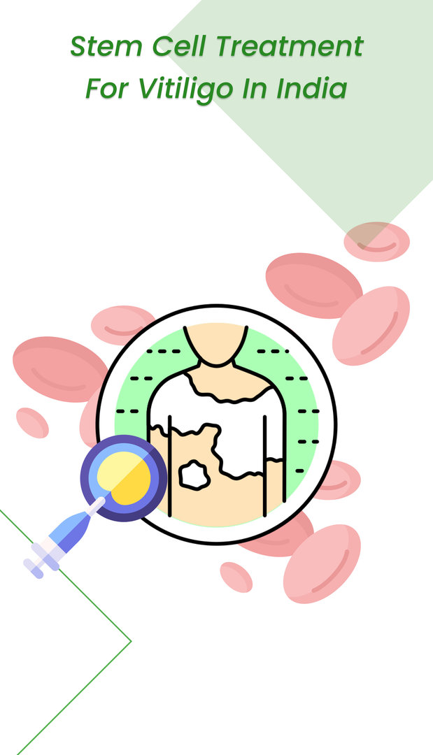 भारत में विटिलिगो के लिए स्टेम सेल उपचार