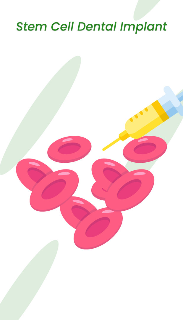 Strategies of cell and cell-free therapies for periodontal regeneration:  the state of the art, Stem Cell Research & Therapy