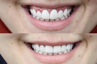 smile beautification smile beautification
