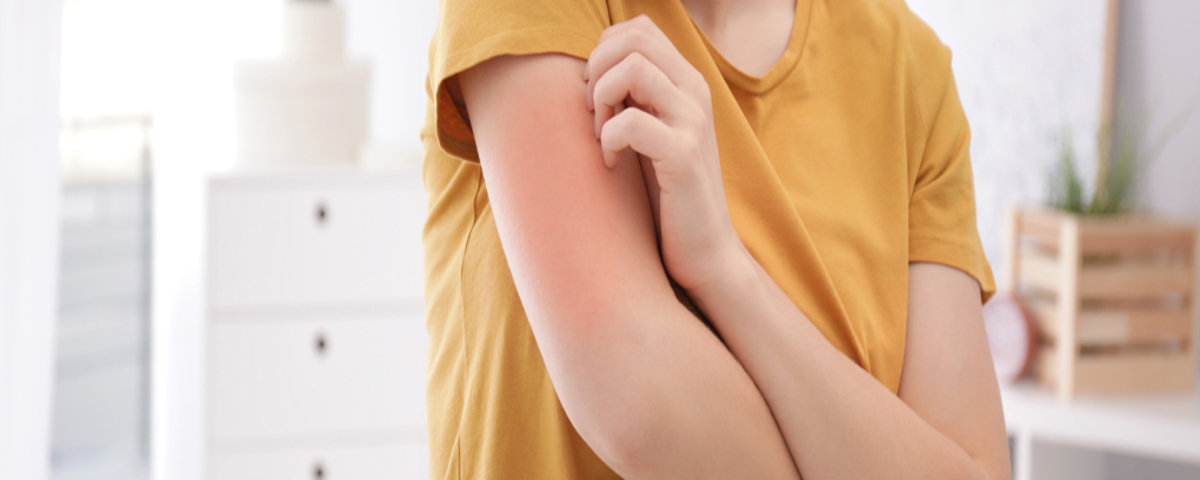 How to Treat Skin Rashes How to Treat Skin Rashes