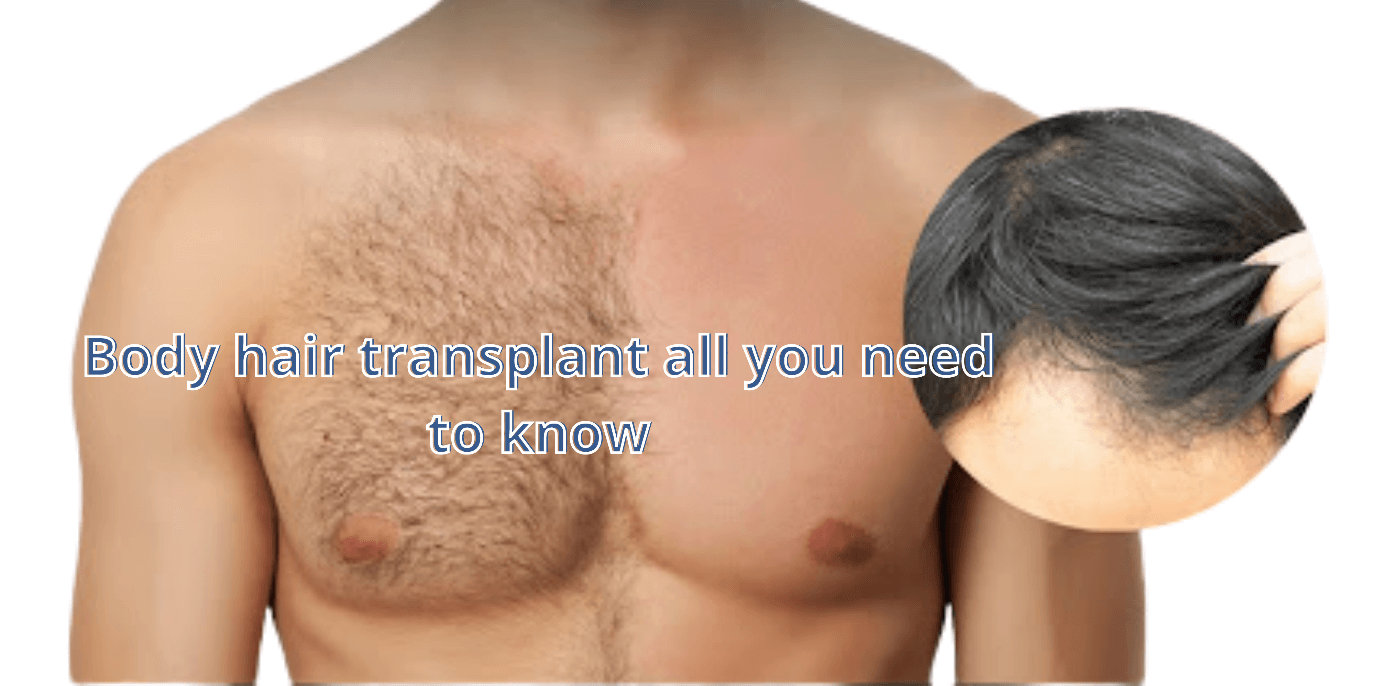 Hair Transplantation in Navi Mumbai हयर टरसपलटशन नव मबई