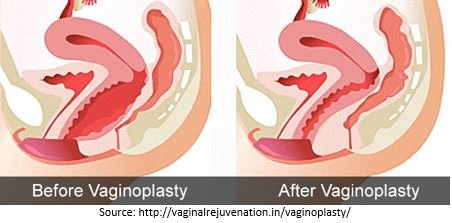 Dr. Anu Sidana best Gynecologist in Ashok Vihar, Gurgaon