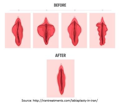 Dr. Anu Sidana best Gynecologist in Ashok Vihar, Gurgaon
