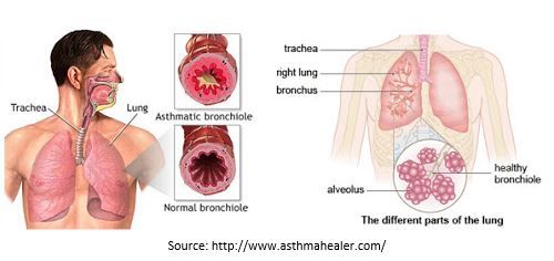 bronchial asthma treatment