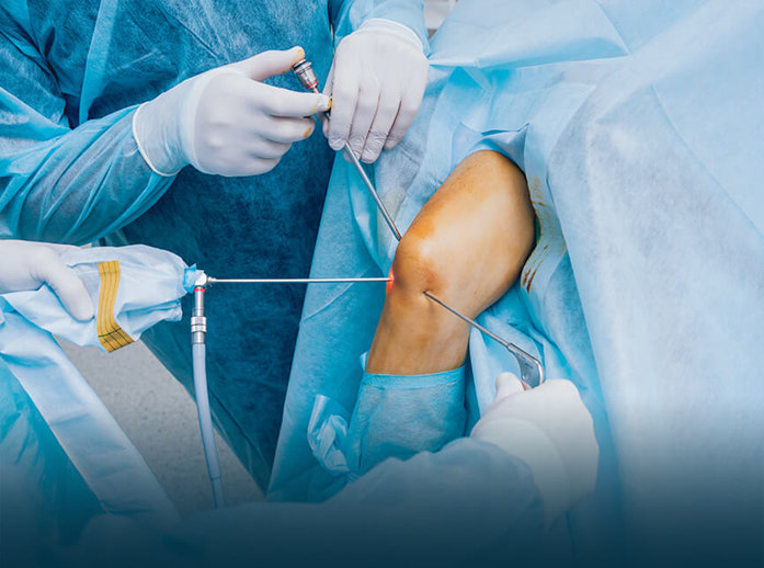 Arthroscopy Image