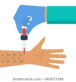 Allergy Skin Test Images