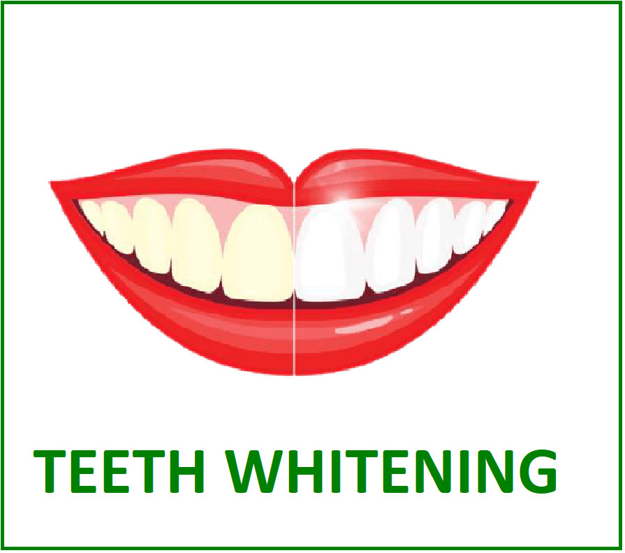 teeth whitening in nungambakkam