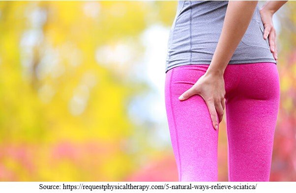Sciatica Sciatica