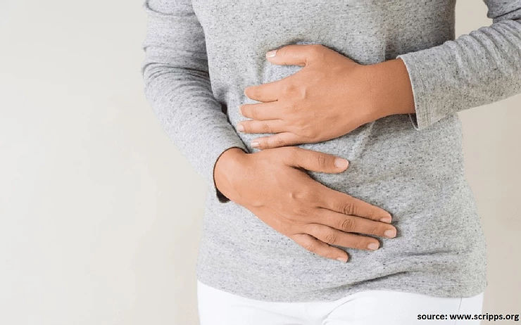 Irritable Bowel Syndrome - All you need to know