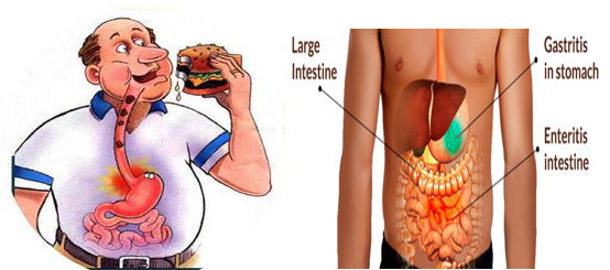 Gastroenteritis